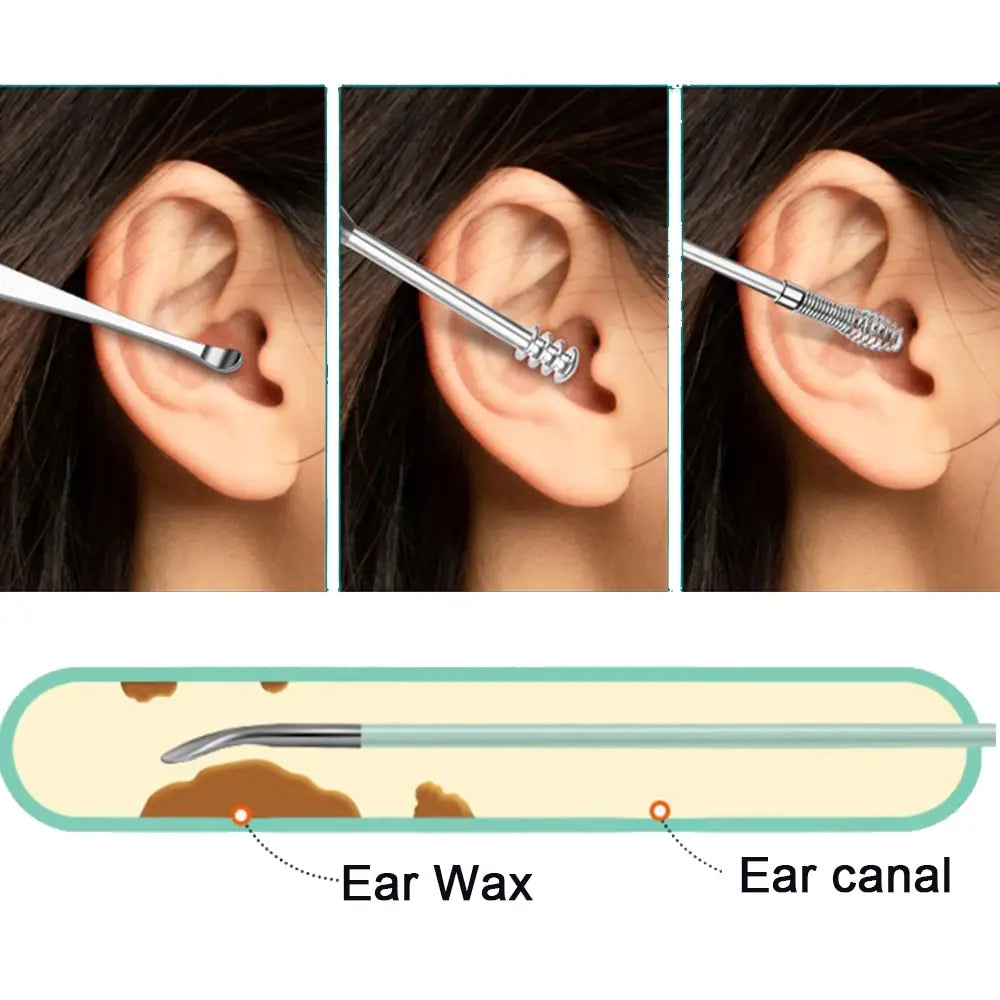 6PCS Ear Cleanser Spoon Health Care Earpick Ear Cleaner Wax Removal Tool Earpick Sticks Earwax Remover Curette Ear Pick Cleaning